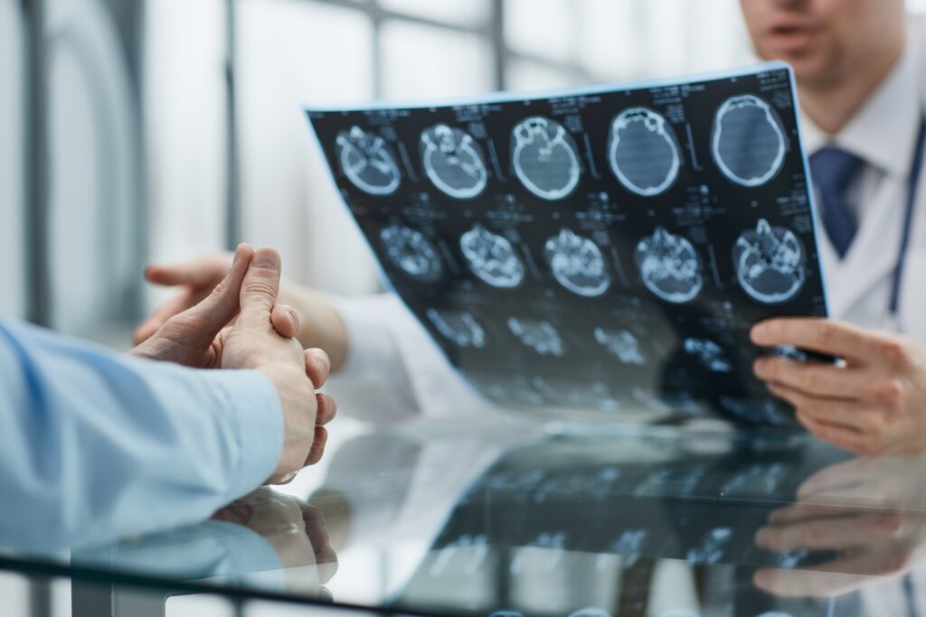 Doctor checking brain MRI of a person injured in a motor vehicle accident