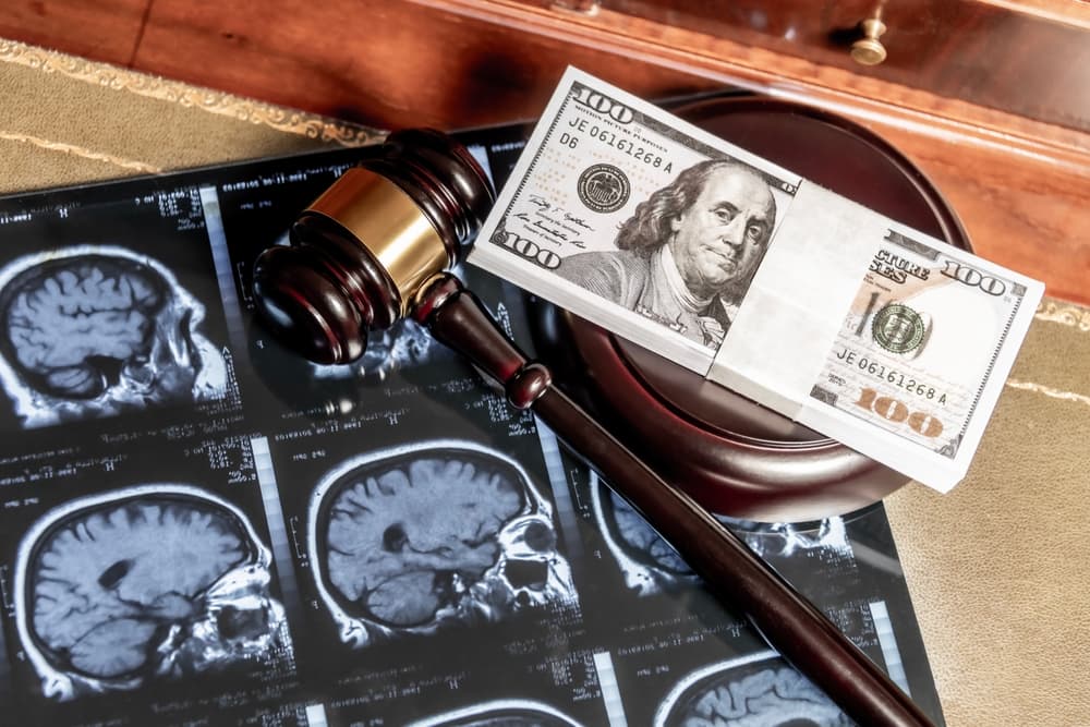 The composite image featuring legal and medical concepts with brain MRI images, a gavel, and US currency.